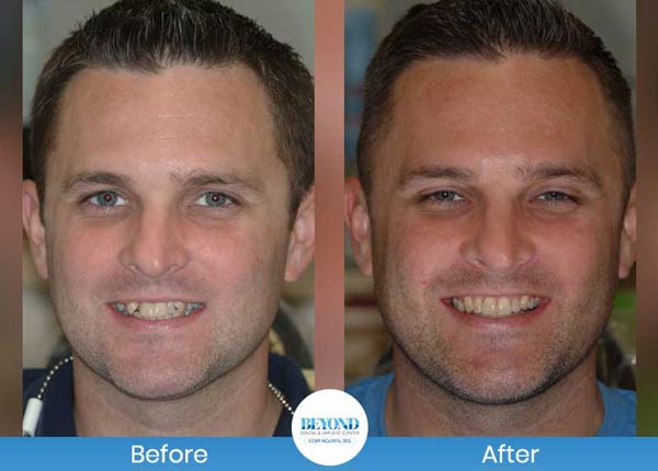 Orthodontics Smile Gallery Near Me in Los Altos, CA