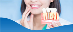 Affordable Dental Implants Near Me in Los Altos, CA Affordable Dental Implants Near Me in Los Altos, CA