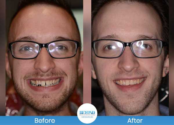 Orthodontics Smile Gallery Near Me in Los Altos, CA