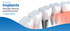 Dental Implants Cost Near Me in Los Altos, CA Dental Implants Cost Near Me in Los Altos, CA