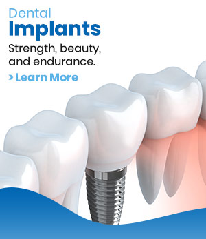 Dental Implants Near Me in Los Altos, CA
