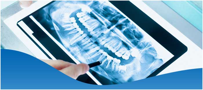 Digital X-Ray Services Near Me in Los Altos, CA Digital X-Ray Services Near Me in Los Altos, CA