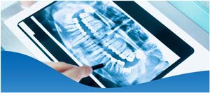 Digital X-Ray Services Near Me in Los Altos, CA Digital X-Ray Services Near Me in Los Altos, CA