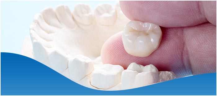 Crown Lengthening Procedure Specialist Near Me in Los Altos, CA Crown Lengthening Procedure Specialist Near Me in Los Altos, CA