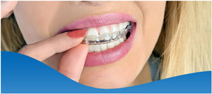 Teeth Grinding and Clenching Treatment Specialist in Los Altos, CA