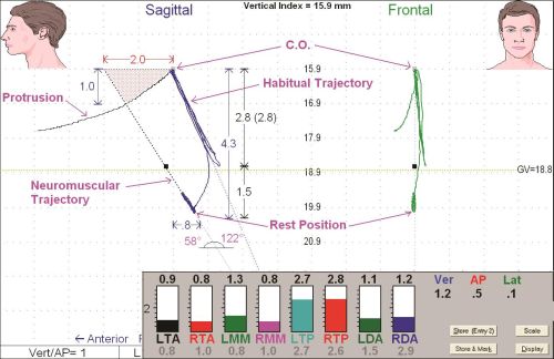 Sign & Symptoms of TMJ Disorder Near Me in Los Altos, CA Sign & Symptoms of TMJ Disorder Near Me in Los Altos, CA