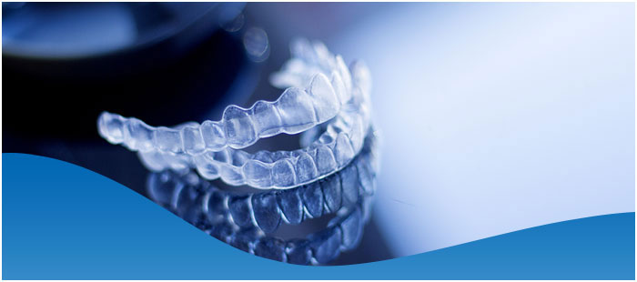 How Much Does Invisalign Cost in Los Altos, CA