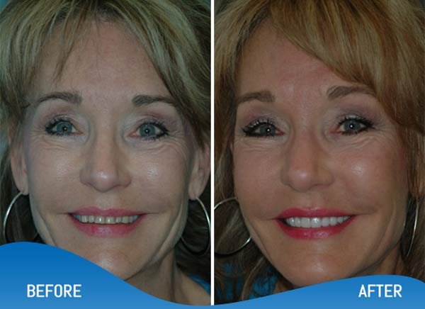 Restorative Dentist Near Me in Los Altos, CA and Fort Worth, TX Restorative Dentist Near Me in Los Altos, CA and Fort Worth, TX