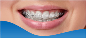 Questions to Ask Your Neuromuscular Orthodontics Near Me in Los Altos, CA Questions to Ask Your Neuromuscular Orthodontics Near Me in Los Altos, CA