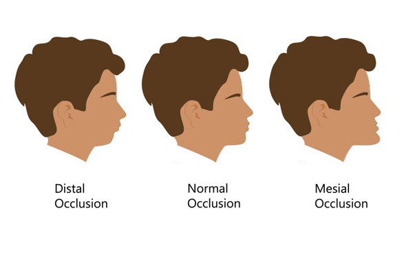 Orthodontic Dentist Near Me in Los Altos, CA and Fort Worth, TX
