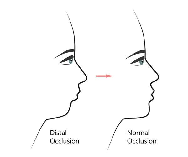 Orthodontic Dentist Near Me in Los Altos, CA and Fort Worth, TX
