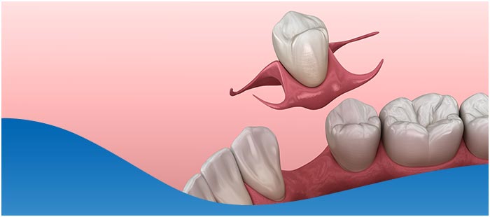 Missing Teeth and Bone Loss Treatment Specialist Near Me in Los Altos, CA Missing Teeth and Bone Loss Treatment Specialist Near Me in Los Altos, CA