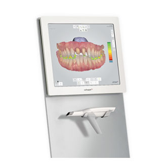 Trios-3 Digital Impression Scanner Near me in Los Altos, CA Trios-3 Digital Impression Scanner Near me in Los Altos, CA