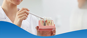 Full Mouth Dental Implants Dentist Near Me in Los Altos, CA Full Mouth Dental Implants Dentist Near Me in Los Altos, CA