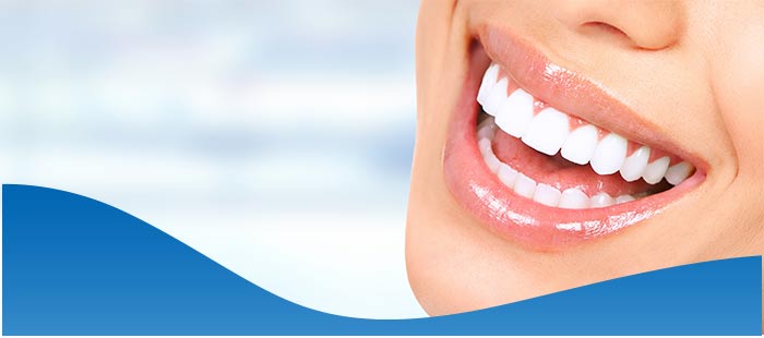 Cost of Full Mouth Dental Implants Near Me in Los Altos, CA Cost of Full Mouth Dental Implants Near Me in Los Altos, CA