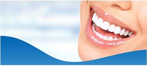 Cost of Full Mouth Dental Implants Near Me in Los Altos, CA Cost of Full Mouth Dental Implants Near Me in Los Altos, CA