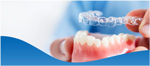 Cost of Invisalign Near Me in Los Altos, CA
