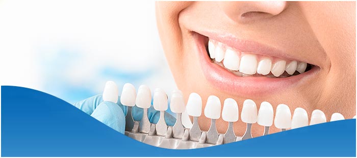Cost of Dental Whitening Near Me in DFW Area Cost of Dental Whitening Near Me in DFW Area