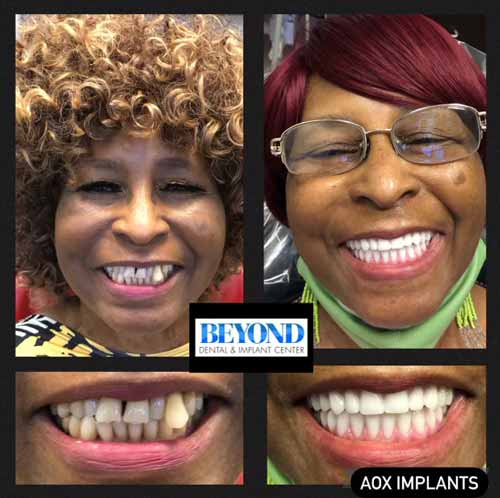 All-on-4 Implants Specialist Near Me in Los Altos, CA