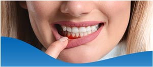 Tips for Prevention Periodontal Disease in Los Altos, CA Tips for Prevention Periodontal Disease in Los Altos, CA