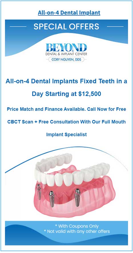 All-On-4 Dental Implants Offers in DFW Area