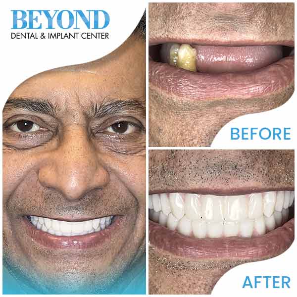 ABC Dental Clinic & Implant Center Real patients, real results and real beautiful new smiles in Los Altos, CA (DFW Area) ABC Dental Clinic & Implant Center Real patients, real results and real beautiful new smiles in Los Altos, CA (DFW Area)