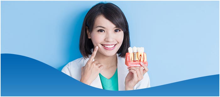 Dental Implants Cost with Insurance Near Me in Los Altos, CA