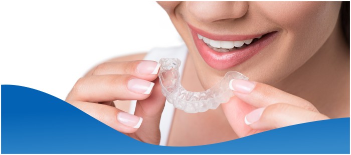 Cost of Clear Aligners Near Me in Los Altos, CA Cost of Clear Aligners Near Me in Los Altos, CA